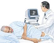 http://www.endourology.com.gr/wp-content/uploads/2010/11/prostate-biopsy-1.bmp